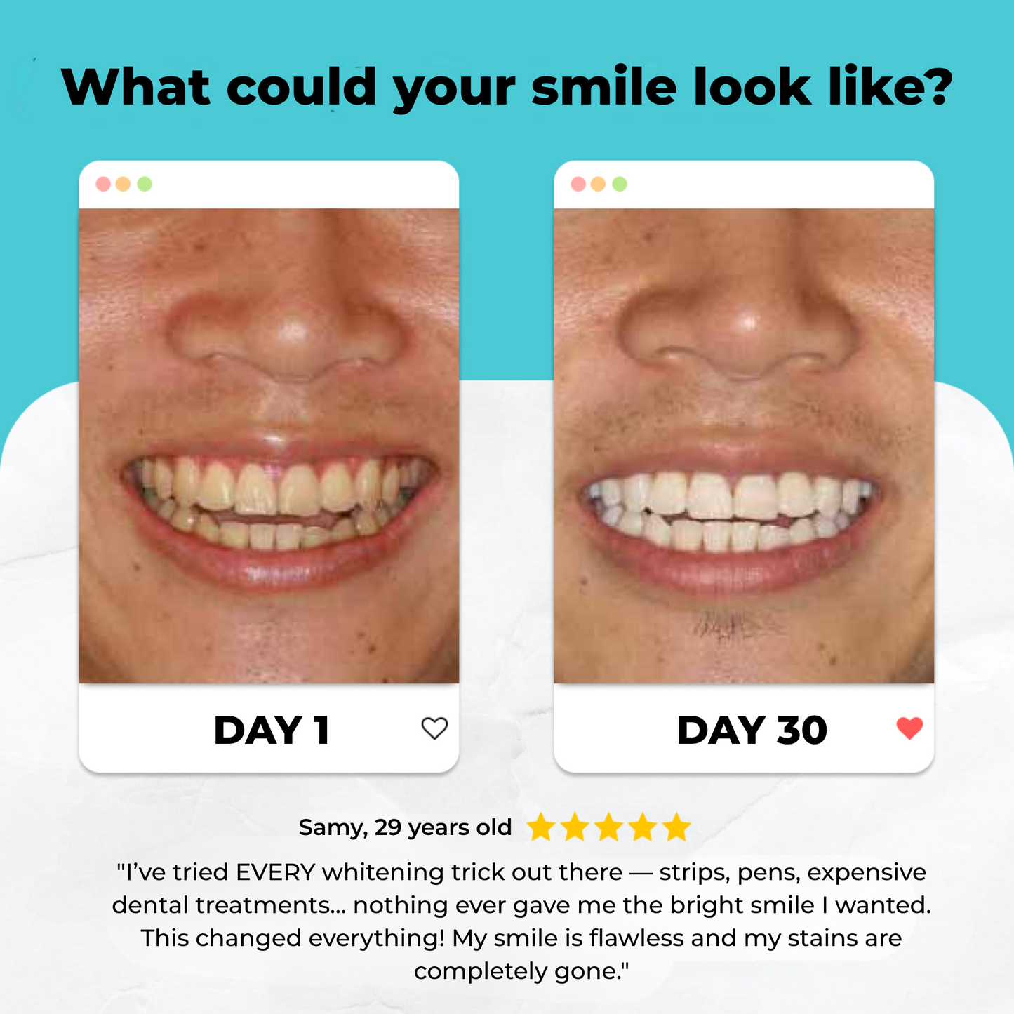 Aura Smile Brush
